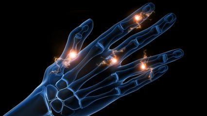 7 domande importanti sull'artrite reumatoide