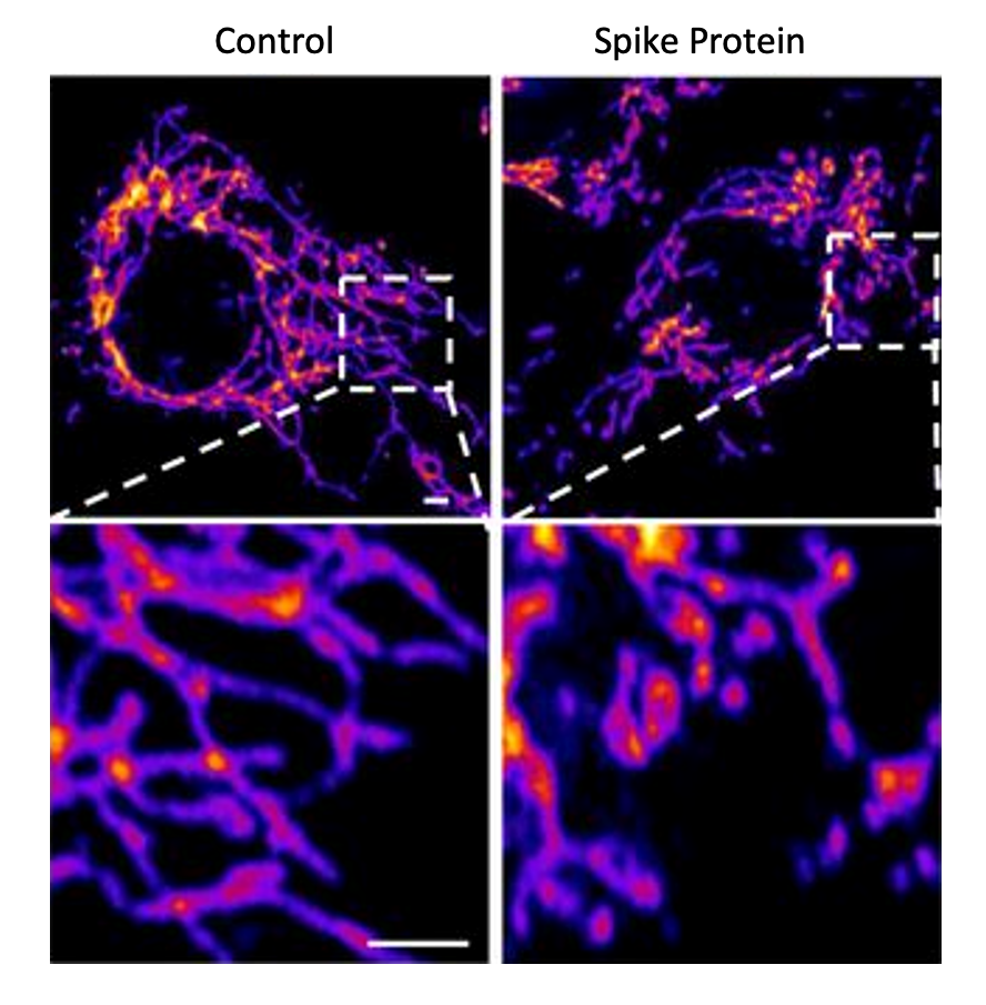 Proteina Spike.Danno cellule vascolari