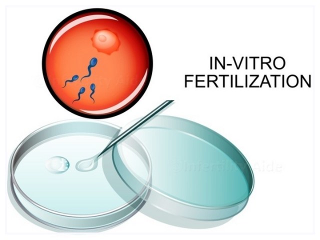 Middle East and Africa In-Vitro Fertilization (IVF) Market Industry Analysis, Trend, Growth, Opportunity, Forecast 2024 – 2032