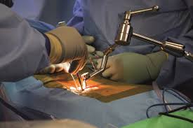 Spine Surgery