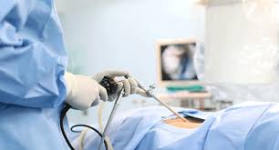 Endoscopy Visualization Systems and Components Market Growth, Share, Opportunities & Competitive Analysis, 2024 – 2032