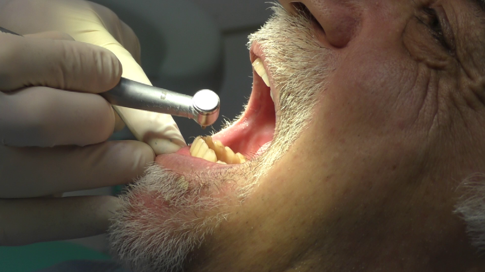 implantologia dentale bologna
