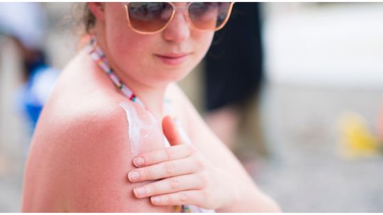 What are The Best Ways to Prevent Sunburn and Skin Damage