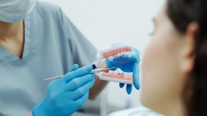 5 idee sbagliate sull'odontoiatria a cui devi smettere di credere
