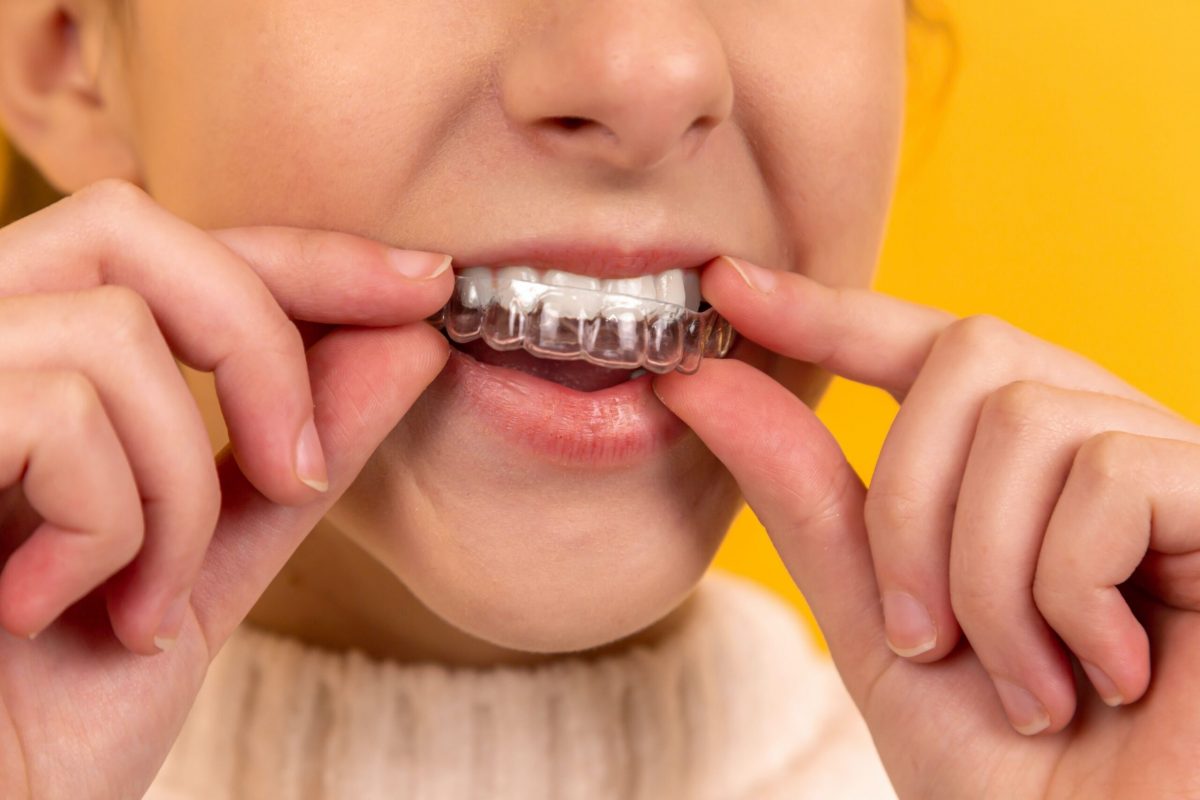Dental Splints Market Size, Industry Trends, Share, Growth and Report 2024-2032