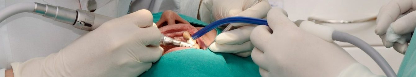 implantologia dentale vicenza prezzi