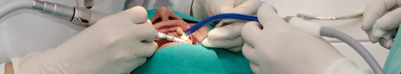 implantologia dentale venezia prezzi