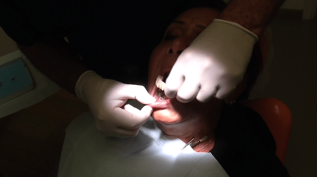 implantologia dentale a carico immediato