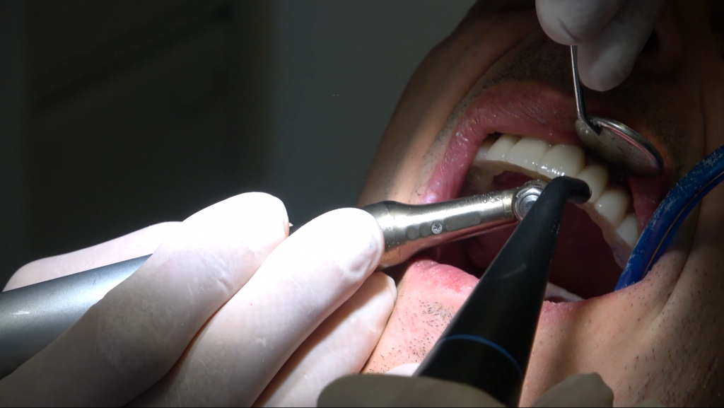 implantologia dentaria