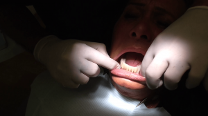 implantologia impianti denti