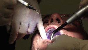 implantologia dnetale impianti denti