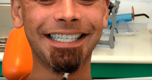 implantologia dentale varese