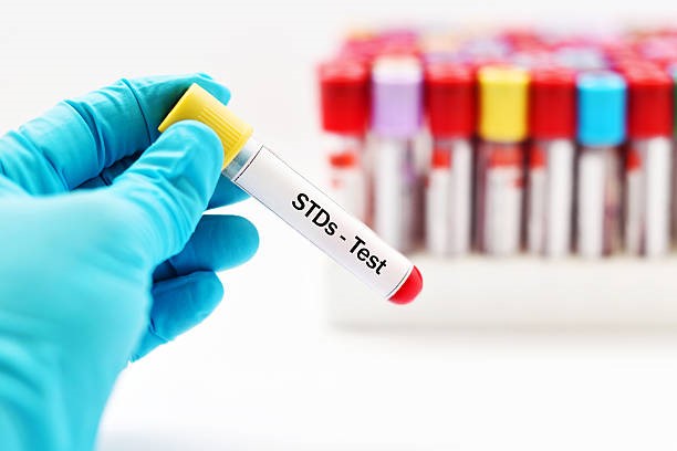 Online, you may get a dozen STD tests, but should you?