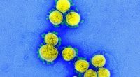 5181865_1518_coronavirus_aria_30