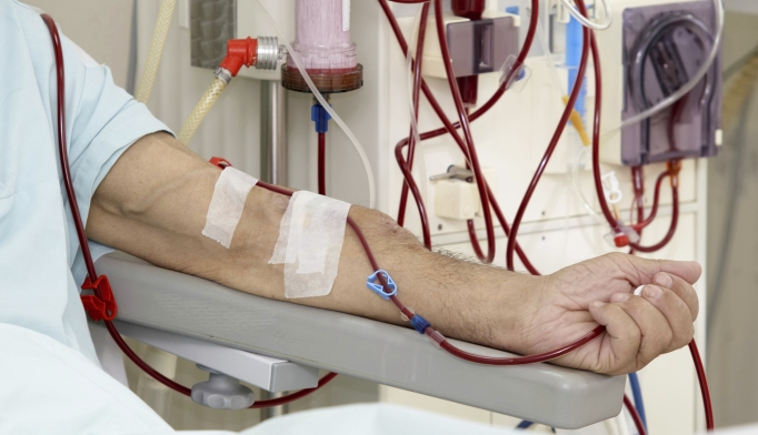 Hemodialysis Market Size 2023 | Industry Trends, Report Analysis and Forecast 2028