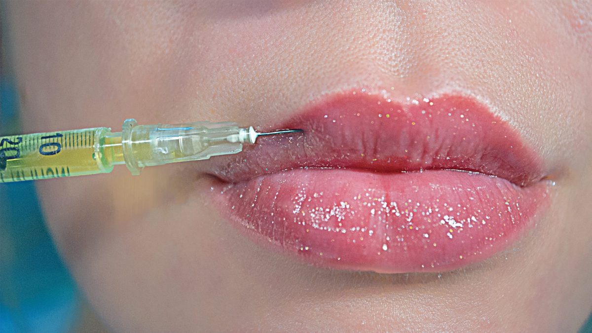Lip Augmentation Market 2023 | Industry Trends, Growth and Forecast 2028