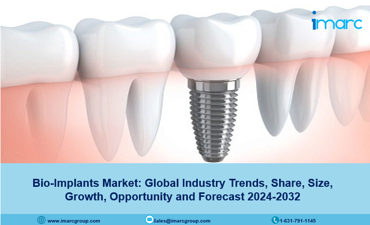 Bio-Implants Market Growth, Size, Share, Trends, Demand and Forecast 2024-2032