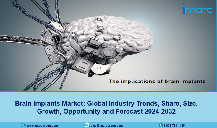 Brain Implants Market Report, Size, Share, Growth, Analysis and Forecast 2024-2032