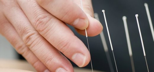 How Successful is Acupuncture in Losing Weight