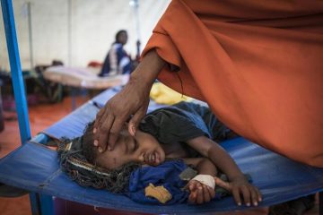 Crisi alimentare senza precedenti, 30mln bimbi malnutriti