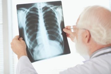 Metodi per diagnosticare la tubercolosi polmonare