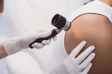 Specialista della talpa, quale medico rimuove le talpe