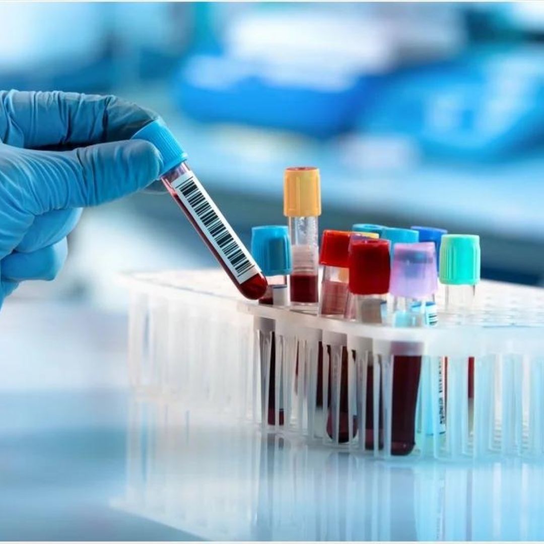 In-Vitro Diagnostics Packaging Market Size, Share, Growth, and Report 2024-2032