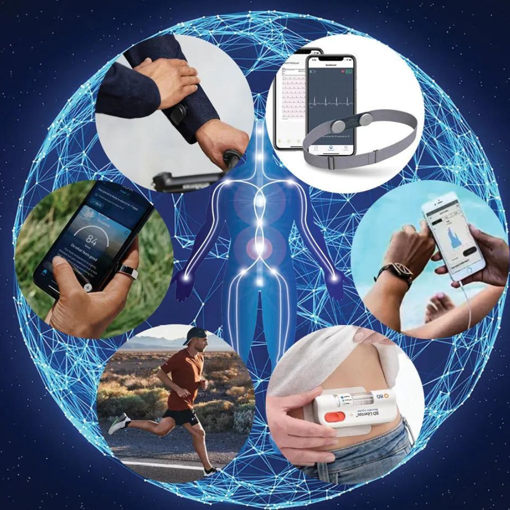 Wearable Electronics Market Size, Industry Share, Growth, Trends, Key Players Analysis and Report 2024-2032