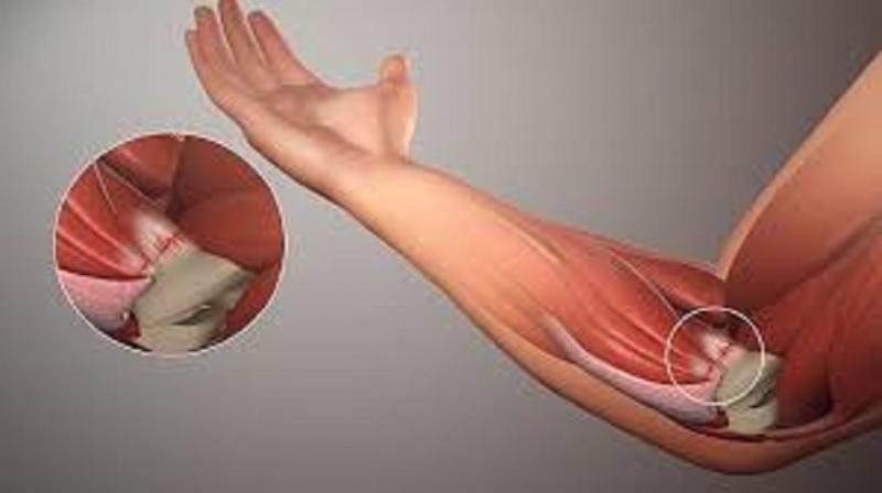 Soft Tissue Repair Market Growth, Size, Inudtry Outlook, and Report 2024-2032