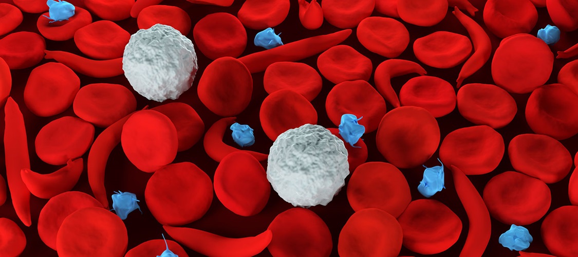Sickle Cell Disease Treatment Market Size, Growth, Trends, and Forecast 2024-2032