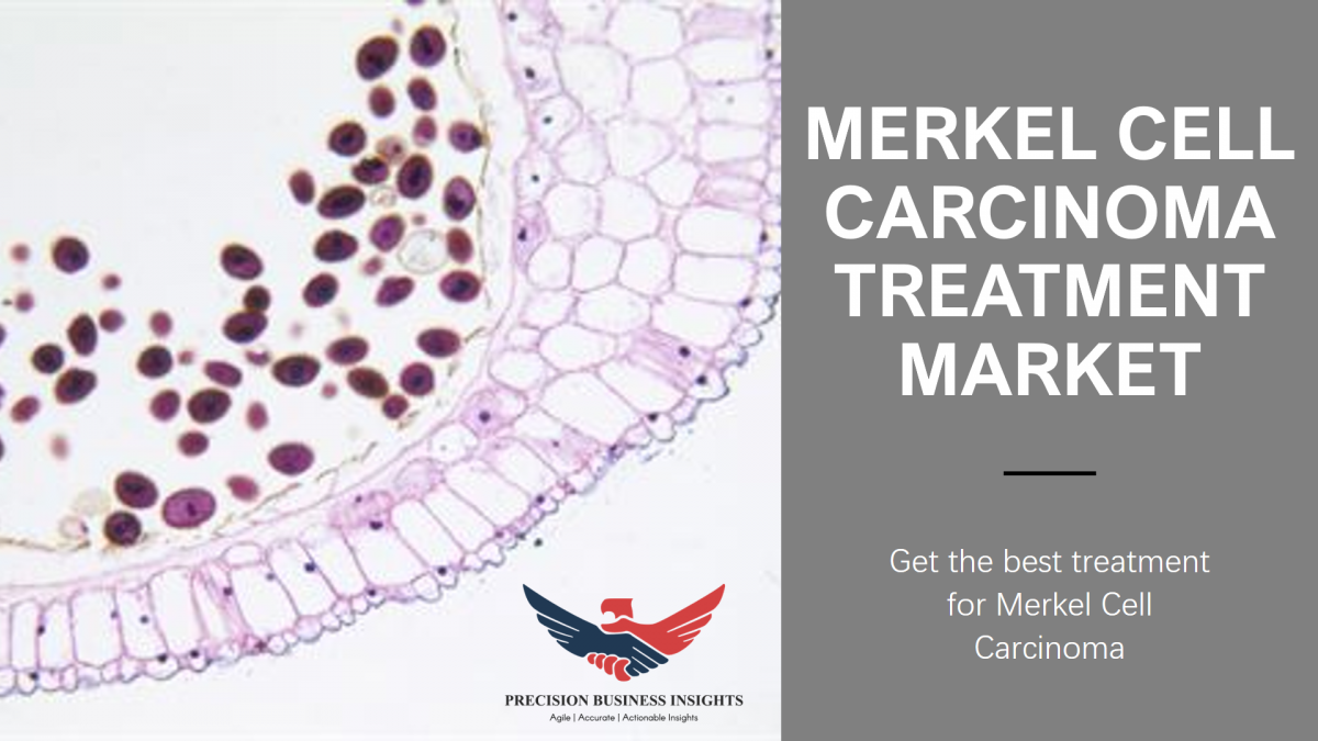 Merkel Cell Carcinoma Treatment Market Size, Growth Analysis 2024