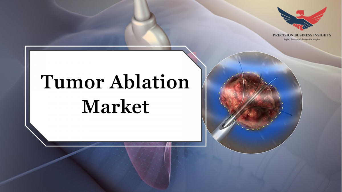 Tumor Ablation Market Share Emerging Growth, Insights, Trends and Forecasts Report 2024