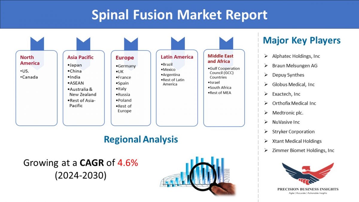 Spinal Fusion Market Overview, Trends, Growth Analysis 2024