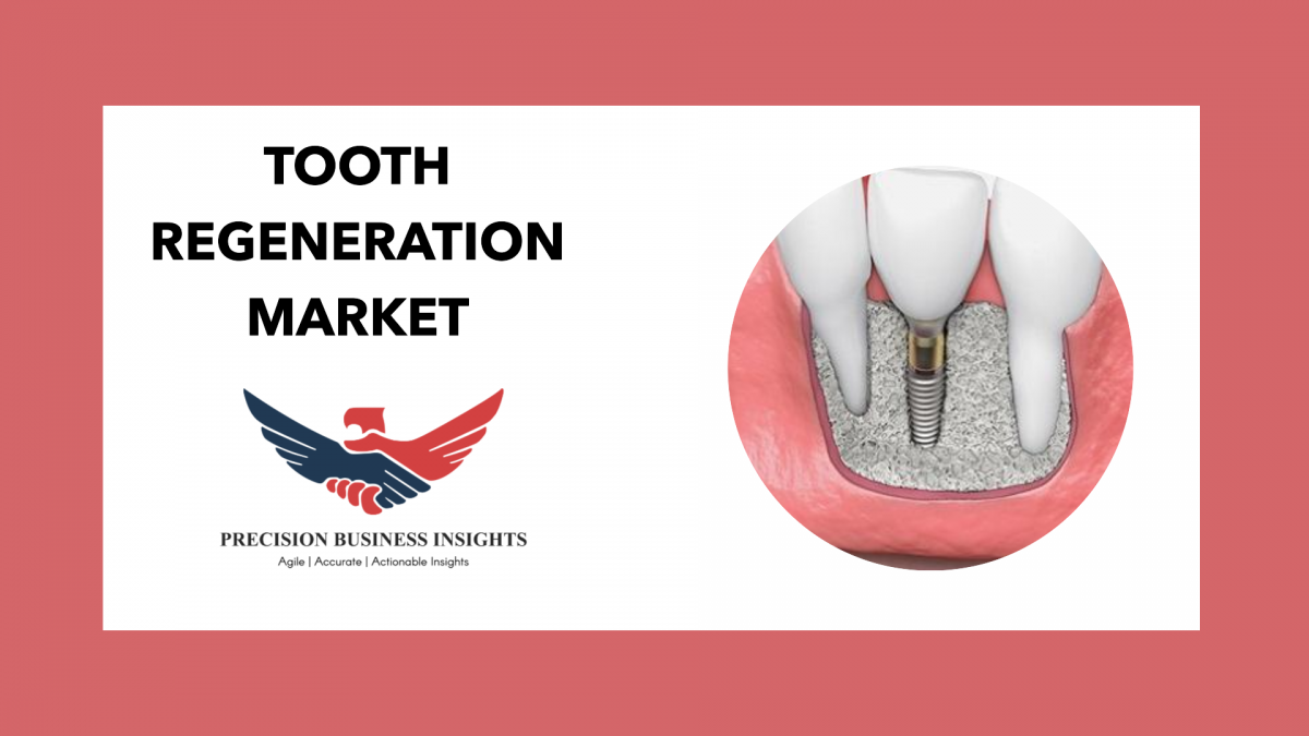 Tooth Regeneration Market Growth Drivers And Trends Forecast 2024-2030