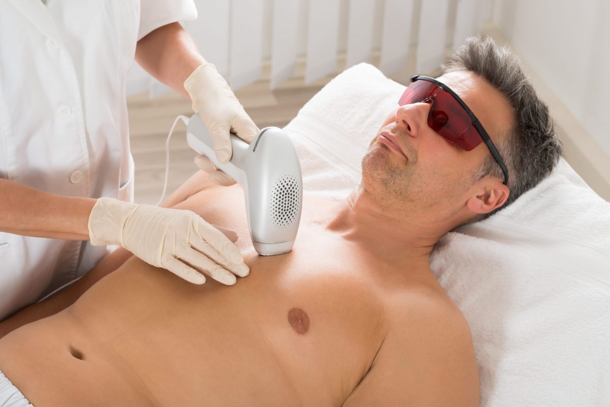 How Much Does Laser Hair Removal Cost in California?