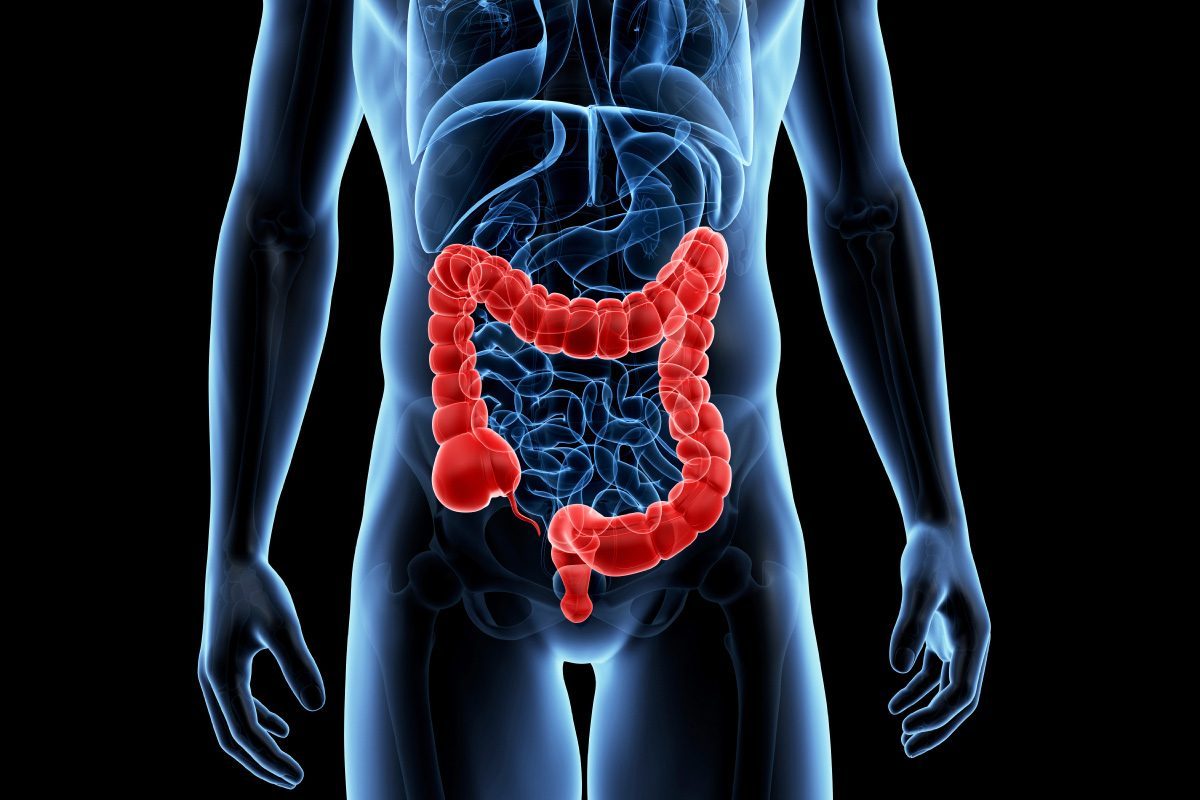 In-Vitro Colorectal Cancer Screening Tests Market