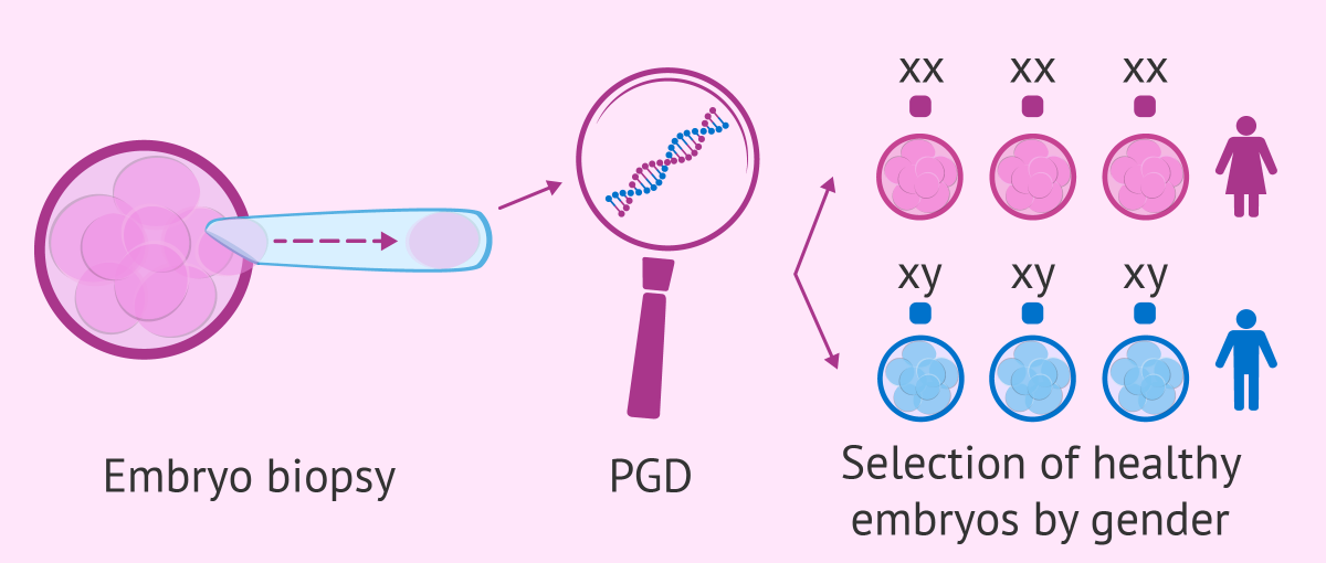 Preimplantation Genetic Testing Market Report 2024-2032, Industry Growth Opportunity, and Forecast