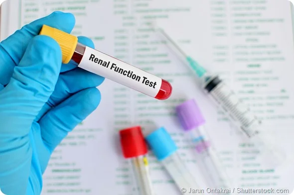 Kidney Renal Function Test Market Share, Size and Forecast 2023-2028