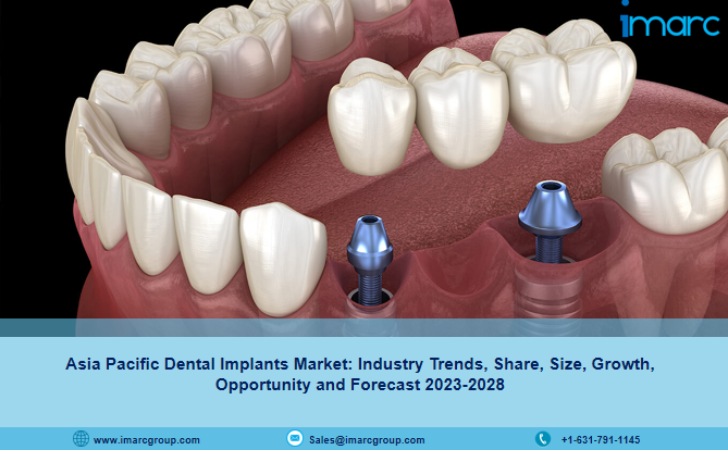 Asia Pacific Dental Implants Market Size, Growth & Trends Report 2023-2028
