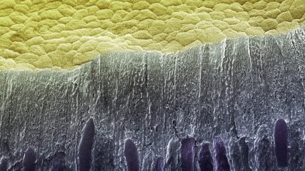 Batteri sui denti al microscopio