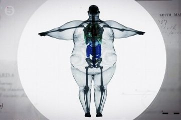Cos'è il sovrappeso e l'obesità