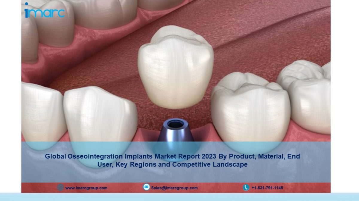 Osseointegration Implants Market Size 2023 | Share and Trends 2028