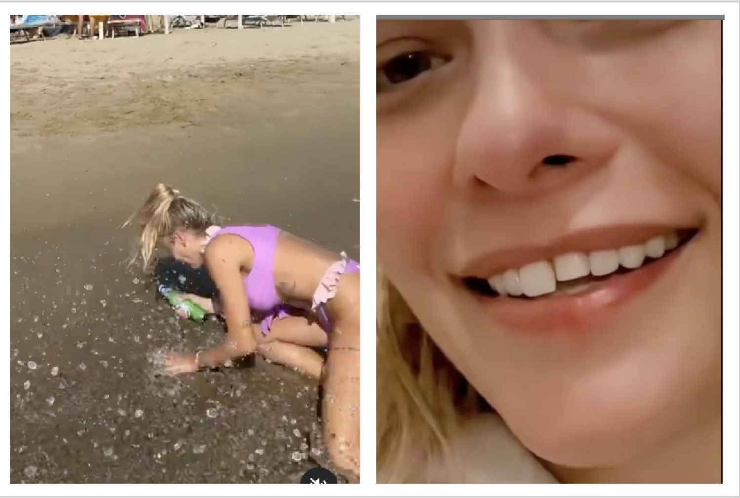 Giulia Provvedi, incidente in spiaggia mentre scherza con la birra: cade a terra e si rompe un dente