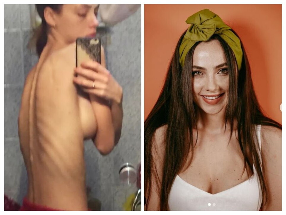 Rosalinda Cannavò shock: “Ecco le foto di quando ero anoressica”. Ma il post viene rimosso