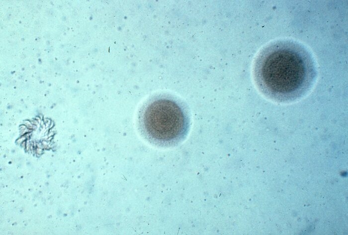 Iss, polmoniti da Mycoplasma comuni fino ai 6 anni di età