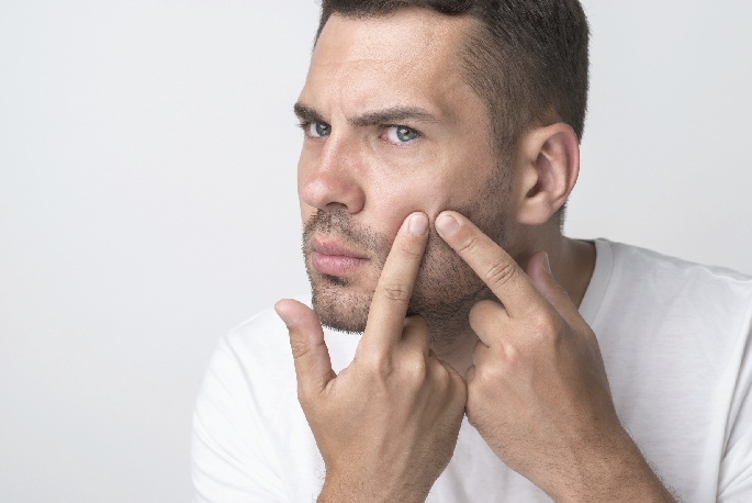 Perché non puoi spremere l'acne sul viso e cosa fare al riguardo